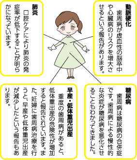 動脈硬化　歯周病が虚血性の脳卒中や心臓病のリスクを増大させるという報告があります。肺炎　口腔ケアにより肺炎の発症率が低下することが明らかになっています。糖尿病　歯周病は糖尿病の合併症です。歯周病による慢性的な炎症が糖尿病を悪化させることもわかってきました。早産・低体重児出産　重度の歯周病があると、低体重出産の危険性が増加すると報告されています。また、妊婦に歯周病治療を行うと、早産や低体重児出産が減少したという報告もあります。