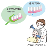 歯間ブラシ、デンタルフロス（糸ようじ）、イラスト：Yuriko R.