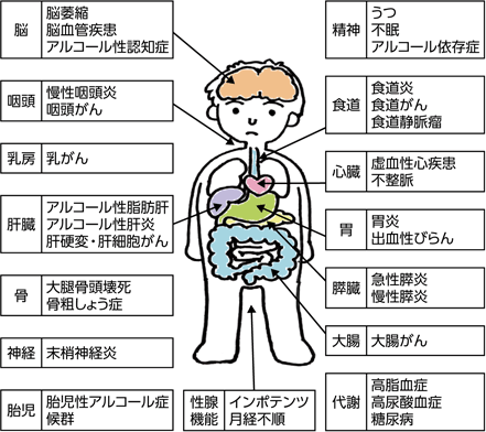 脳
脳萎縮
脳血管疾患
アルコール性認知症

咽頭
慢性咽頭炎
咽頭がん

乳房
乳がん

肝臓
アルコール性脂肪肝
アルコール性肝炎
肝硬変・肝細胞がん

骨
大腿骨頭壊死
骨粗しょう症

神経
末梢神経炎

胎児
胎児性アルコール症候群

性腺機能
インポテンツ
月経不順

代謝
高脂血症
高尿酸血症
糖尿病

大腸
大腸がん

膵臓
急性膵炎
慢性膵炎

胃
胃炎
出血性びらん

心臓
虚血性心疾患
不整脈

食道
食道炎
食道がん
食道静脈瘤

精神
うつ
不眠
アルコール依存症