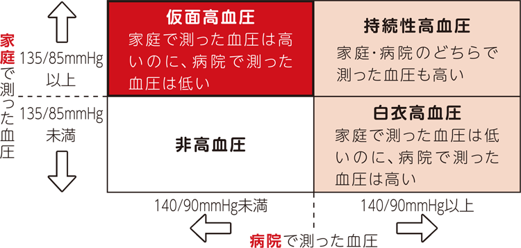 仮面高血圧
	家庭で測った血圧は高いのに、病院で測った血圧は低い
	家庭で測った血圧　135/85mmHg以上
	病院で測った血圧　140/90mmHg未満

	持続性高血圧
	家庭・病院のどちらで測った血圧も高い
	家庭で測った血圧　135/85mmHg以上
	病院で測った血圧　140/90mmHg以上

	非高血圧
	家庭で測った血圧　135/85mmHg未満
	病院で測った血圧　140/90mmHg未満

	白衣高血圧
	家庭で測った血圧は低いのに、病院で測った血圧は高い
	家庭で測った血圧　135/85mmHg未満
	病院で測った血圧　140/90mmHg以上