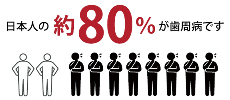 日本人の約80％が歯周病です