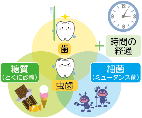 虫歯のできるプロセスのイラスト